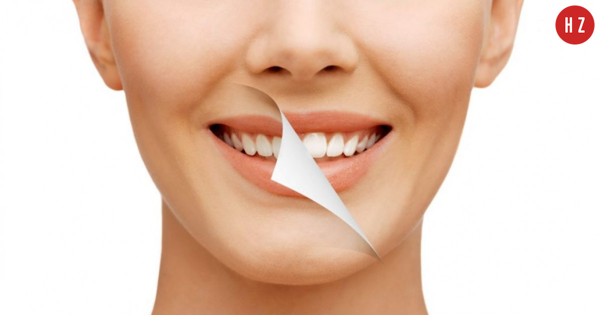 Jak Wybielic Zeby Domowymi Sposobami Hellozdrowie