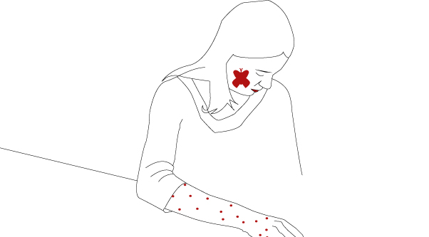 Red flag: wysypka na skórze
