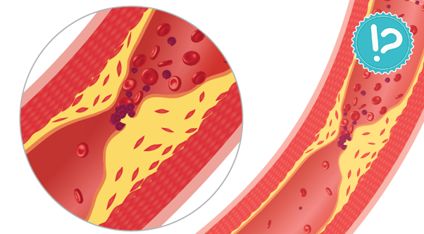Cholesterol – obalamy mity
