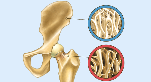 Osteoporoza – chroń się jak ślimak!