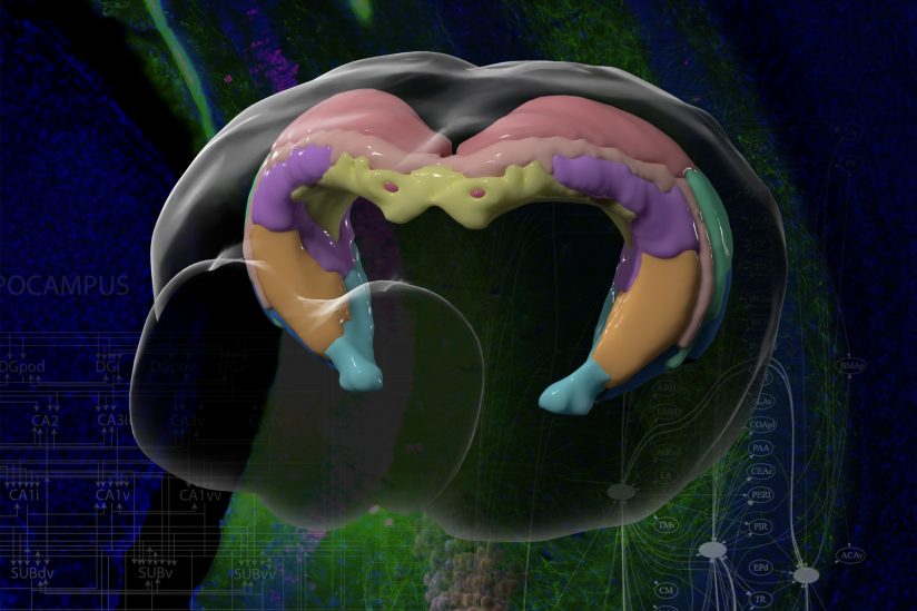 kolorowa mapa mózgu uszkodzonego przez Alzheimera