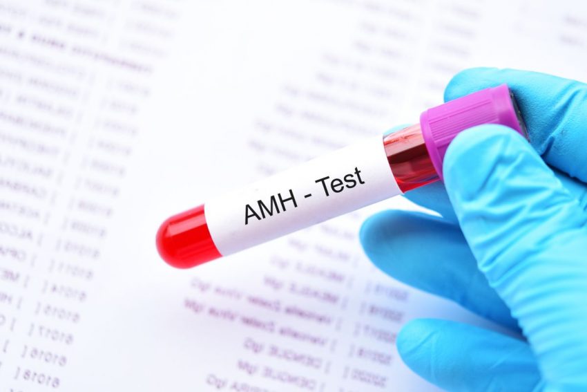 test AMH