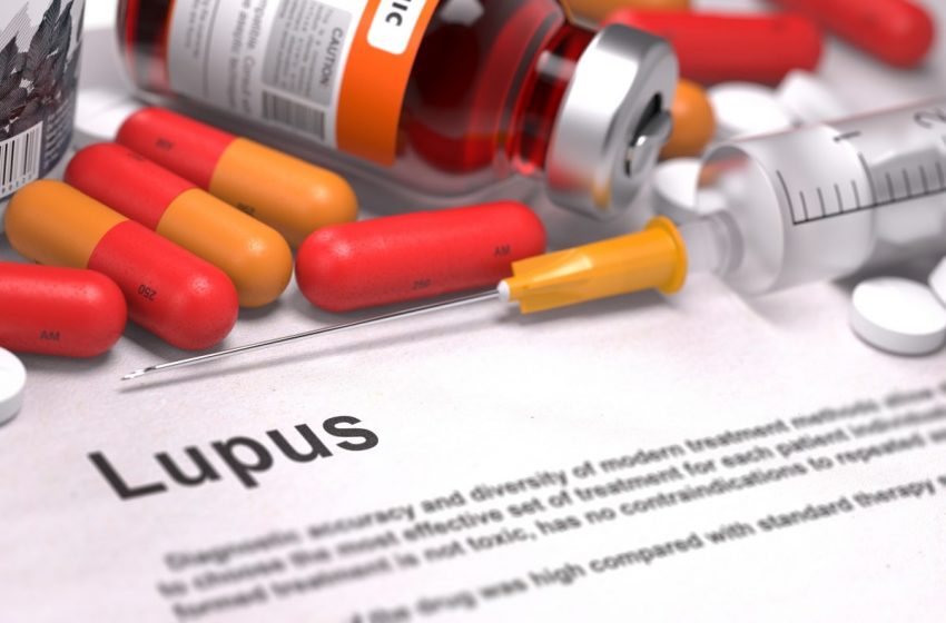 kartka, z napisem lupus (toczeń)