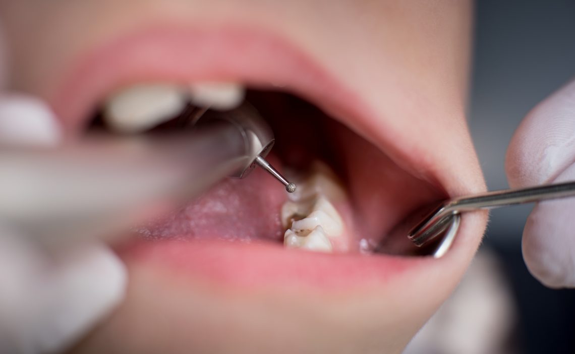Kiedy po raz pierwszy udać się do dentysty z dzieckiem? Dentysta Michał