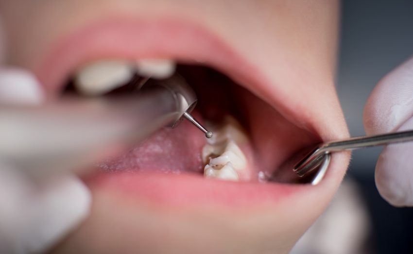 Dziecko u dentysty