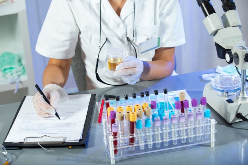 lekarz w laboratorium trzyma próbkę moczu i notuje wyniki na kartce