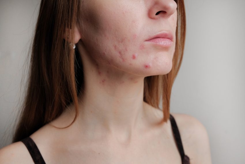 istockphoto.com