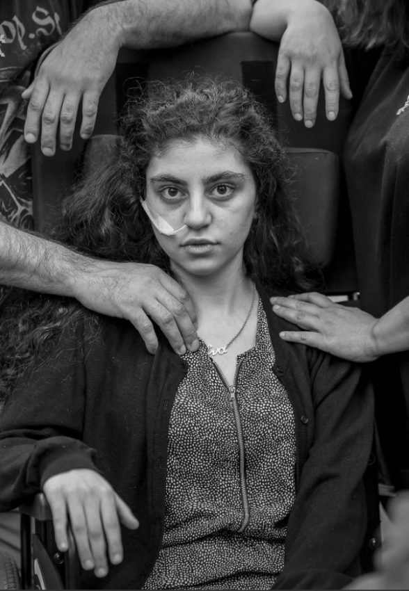 Tekst o nominacji zdjęcia Polaka do World Press Photo. Na zdjęciu: Kobieta z opatrunkiem na twarzy - HelloZdrowie