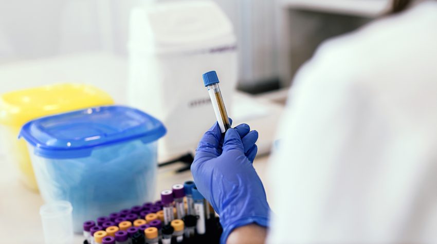 Testy Serologiczne - na czym polegają i kiedy się je wykonuje?