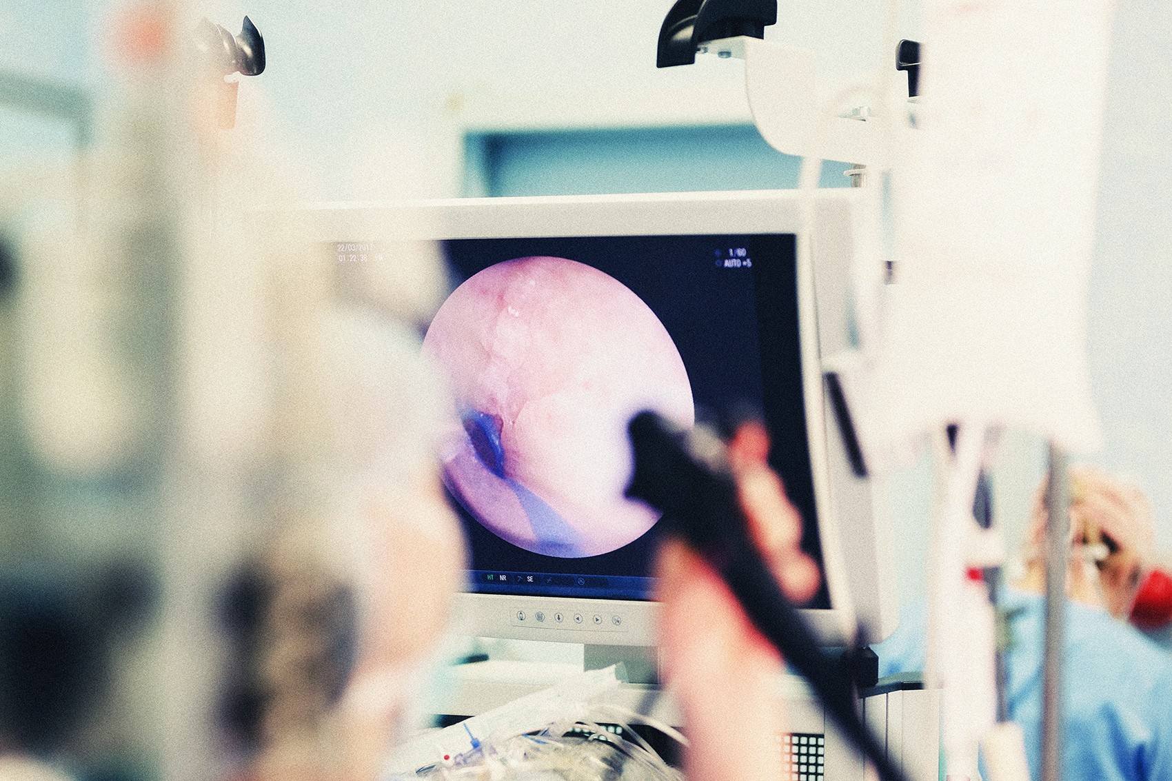 Endoskopia na czym polega i jak przygotować się do tego badania