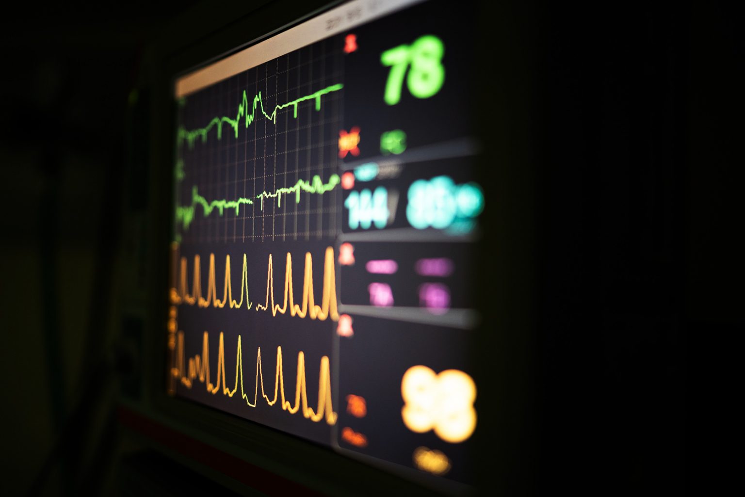 STEMI – przyczyny i objawy zawału STEMI, postępowanie | Hellozdrowie