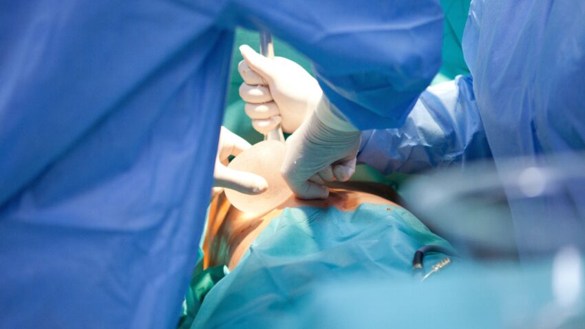 operacja wszczepienia implantów piersi - Hello Zdrowie