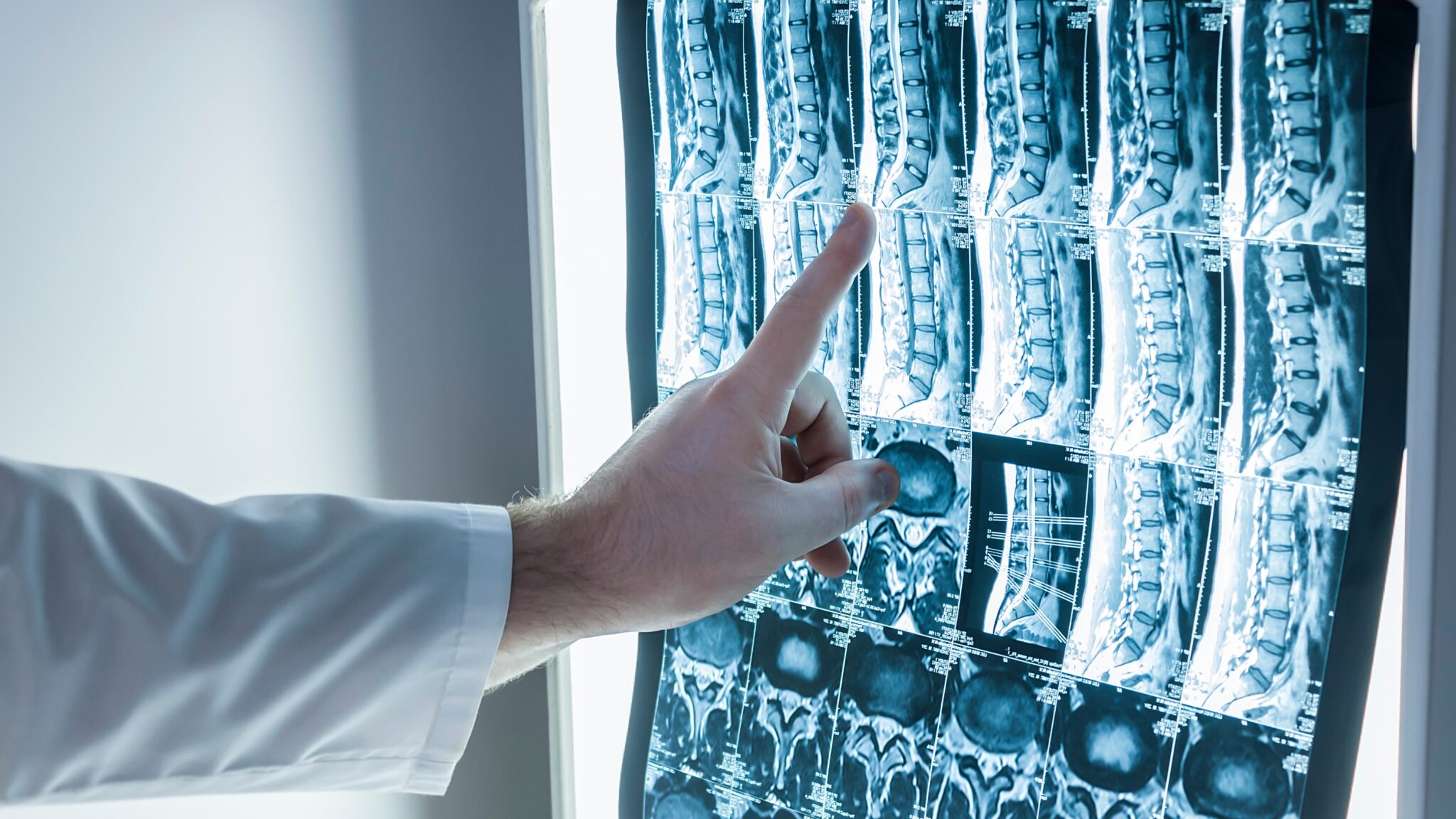 Biopsja Gruboig owa Jakie Mog Wyst pi Powik ania HelloZdrowie