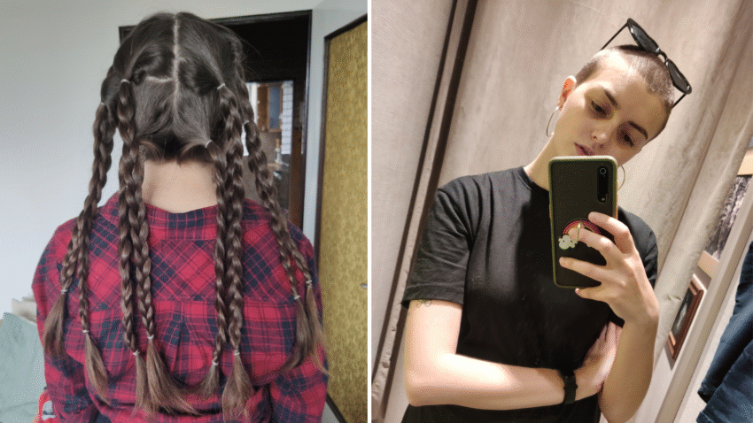 Karolina przed i po zgoleniu włosów - Hello Zdrowie