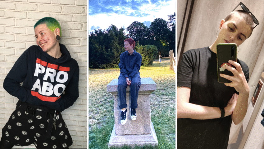 Ewelina, Safo i Karolina zgoliły głowy. Powody miały różne - Hello Zdrowie