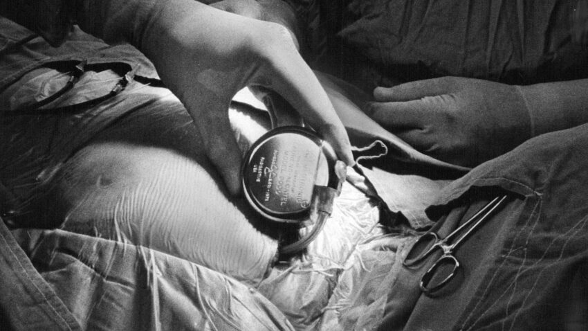 Operacja wszczepienia rozrusznika serca zasilanego energią atomową