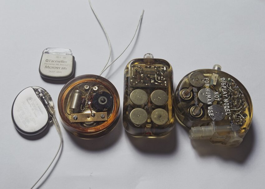 5 rozruszników serca Arne Larssona. Mężczyzna był pierwszym pacjentem, któremu wszczepiono rozrusznik. Niebawem trzeba było go wymienić. Arne przeżył z kolejnymi, coraz nowocześniejszymi urządzeniami, 42 lata - Hello Zdrowie